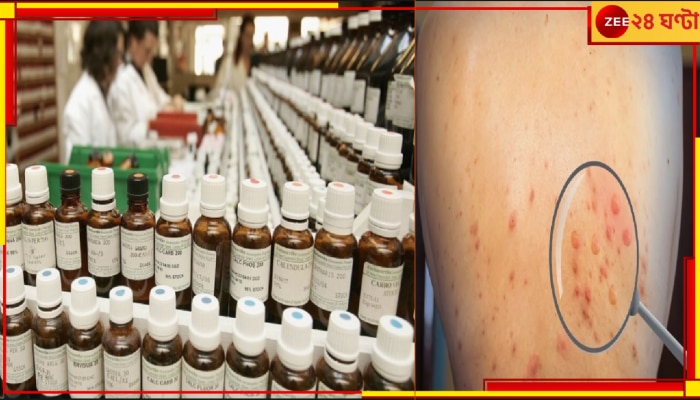 Magic Medicines for Monkeypox: ম্যাজিক? চলে এল মাঙ্কি পক্সের হোমিওপ্যাথি ওষুধ! অনন্য আবিষ্কার বাঙালির... Magic Medicines for Monkeypox: ম্যাজিক? চলে এল মাঙ্কি পক্সের হোমিওপ্যাথি ওষুধ! অনন্য আবিষ্কার বাঙালির...