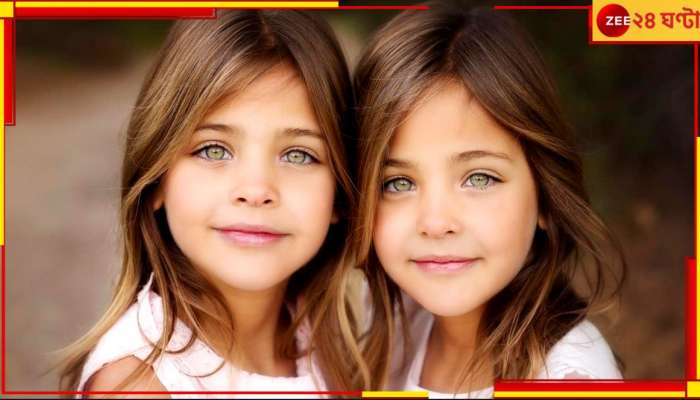  World&#039;s most beautiful twins: মাত্র ৭ বছর বয়সে এরাই ছিলেন বিশ্বের সেরা সুন্দরী যমজ! এখন তাদের কী অবস্থা?