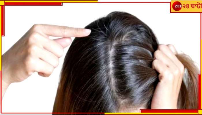 Grey Hair Treatment: সাবধান! এই ভিটামিন কম থাকলেই পাকবে চুল!