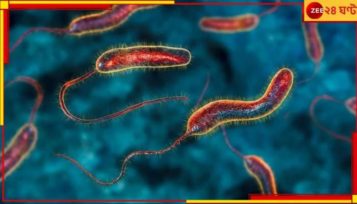 Cholera Outbreak: ভয়ংকর ব্যাকটেরিয়া থেকে হাড়হিম পরিস্থিতি! তিন দিনে মৃত প্রায় ৬০, আক্রান্ত ১৩০০...