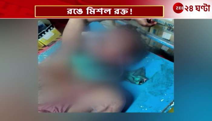 A young man close to a councilor was hacked to death on the street in public