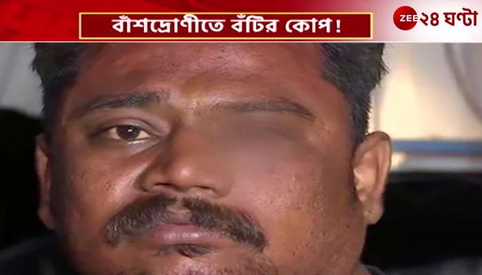 4 people injured in Tulkalam bamboo grove