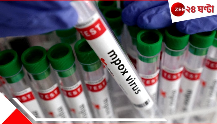 Mpox: পূর্ব আফ্রিকায় মহামারীর আকার নিয়েছে mpox, ভারতেও চোখ রাঙাচ্ছে সংক্রমক এই রোগ! Mpox: পূর্ব আফ্রিকায় মহামারীর আকার নিয়েছে mpox, ভারতেও চোখ রাঙাচ্ছে সংক্রমক এই রোগ!