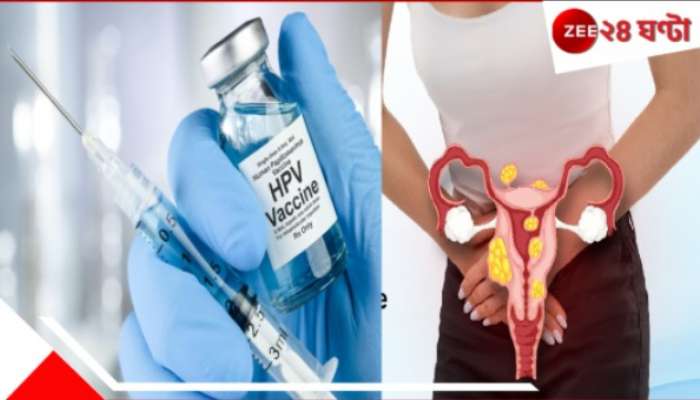 Cervical Cancer | HPV Vaccine: সবাই বলছে বলেই জরায়ু ক্যানসার রুখতে ভ্যাকসিন নেবেন? জরুরি এই কথাগুলো জানেন কি? Cervical Cancer | HPV Vaccine: সবাই বলছে বলেই জরায়ু ক্যানসার রুখতে ভ্যাকসিন নেবেন? জরুরি এই কথাগুলো জানেন কি?
