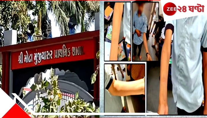 Ahmedabad School Incident: জুয়ার নেশায় রক্তারক্তি প্রাইমারি স্কুলে, ১০ টাকা জেতার লোভে ব্লেড দিয়ে ৪০ পড়ুয়া...