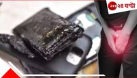 পকেটেই ফাটল মোবাইল ফোন, গোপনাঙ্গ ঝলসে গিয়ে...