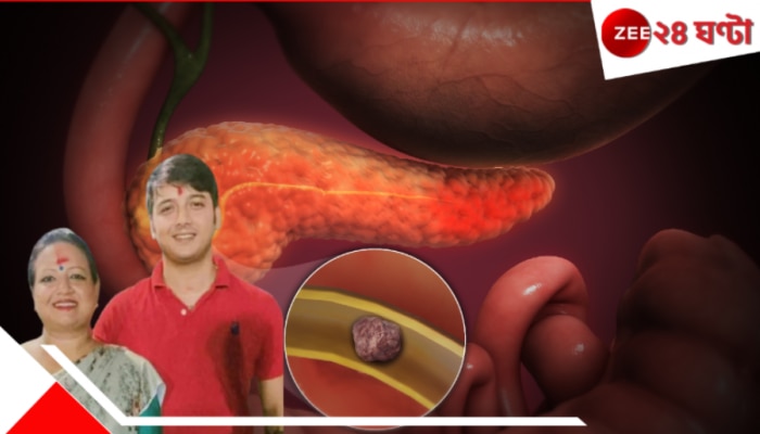 Hemorrhagic Pancreatitis: হেমারেজিক প্যানক্রিয়াটাইটিসে ২৫-এই মৃত্যু প্রীতমের! কী এই ভয়ংকর রোগ? কী তার উপসর্গ...