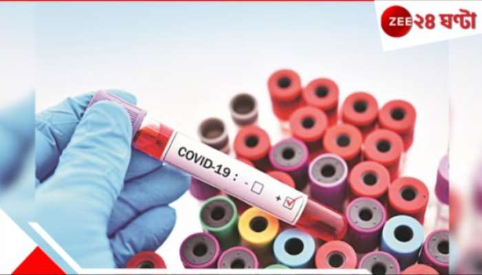 Covid 19 cases: ৩০ মৃত্যু! কেন হঠাৎ বাড়ছে কোভিডের সংক্রমণ! বিশেষজ্ঞরা বলছেন...