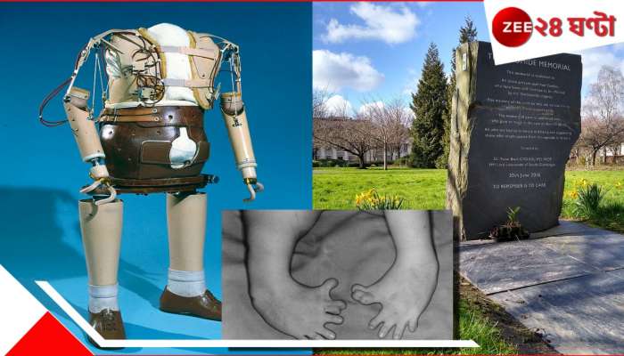 Mermaid Babies:  এক 'ভয়ংকর' ওষুধে ৪৬ দেশে 'মারমেইড বেবি'! ২০০০০ শিশুর... ইতিহাসে সবচেয়ে বড় মেডিক্যাল বিপর্যয়...