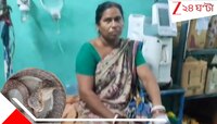 পেয়ারাবাগানে আচমকা কামড় ভয়ংকর চন্দ্রবোড়ার, পাল্টা দিলেন গৃহবধূ