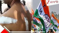 তৃণমূল পঞ্চায়েত সদস্যের স্বামীকে প্রকাশ্যে দেদার ধারাল অস্ত্রের কোপ! অভিযোগ...