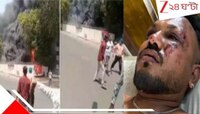 'আগুনের গোলা থেকে হেঁটে বেরোলেন, বেঁচেও ফের আগুনেই ঝাঁপ দিতে যাচ্ছিলেন!' ভয়ংকর...