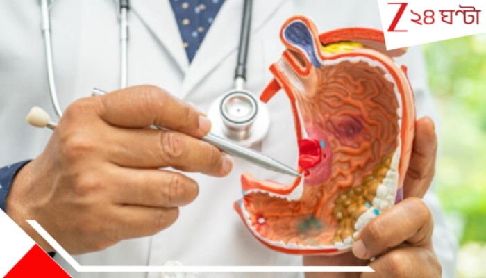 Stomach Cancer: ২০০৮ এর পর জন্ম? ভবিষ্যতে হতে পারে মারণরোগ!