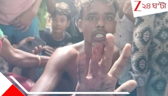 Civic Volunteer: সিভিক ভলেন্টিয়ারের দাদাগিরি! আঙুল কে*টে পড়ে গেল যুবকের! ভয়ংকর ঘটনা...