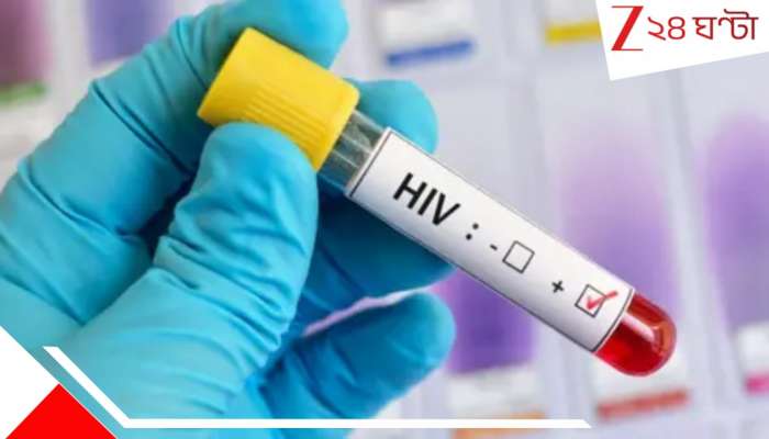 Woman kills HIV positive brother: এইডস আক্রান্ত ভাই! চিকিৎসা করানোর নামে দিদি নিজের হাতেই ভাইকে... একী করলেন! হতভম্ব সবাই...