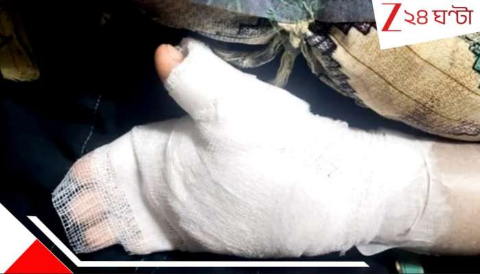 Mumbai Tutor Torture: কী বিচ্ছিরি হাতের লেখা! সবক শেখাতে খুদে পড়ুয়ার মুঠোর নীচে জ্বলন্ত মোমবাতি... টিউটরের টর্চার... Mumbai Tutor Torture: কী বিচ্ছিরি হাতের লেখা! সবক শেখাতে খুদে পড়ুয়ার মুঠোর নীচে জ্বলন্ত মোমবাতি... টিউটরের টর্চার...