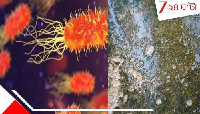 Brain eating Amoeba: পুকুরে স্নান করলেই মাথায় ঢুকে যাচ্ছে ভয়ংকর অ্যামিবা! কুড়ে খেয়ে নিচ্ছে মগজ... আবারও শিকার এক যুবক, এই নিয়ে ৬...