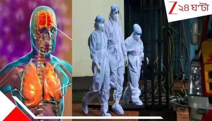 Nipah Virus: বাংলায় ভয়ংকর নিপাকে রুখতে কেন্দ্র-রাজ্য জয়েন্ট রেসপন্স টিম! কোন মাংস এখন একদমই খাবেন না? কী বলছে বিশেষজ্ঞদের গাইডলাইন...