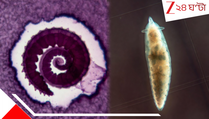 Snail Fever: দেশে দেশে ছড়াচ্ছে যৌনাঙ্গে সংক্রমকারী ভয়ংকর এই পরজীবী, জানুন স্নেইল ফিভার সম্পর্কে Snail Fever: দেশে দেশে ছড়াচ্ছে যৌনাঙ্গে সংক্রমকারী ভয়ংকর এই পরজীবী, জানুন স্নেইল ফিভার সম্পর্কে