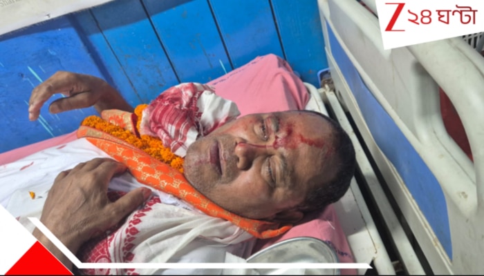 West Bengal Assembly Election 2026: যত কাণ্ড ময়নাগুড়িতে: প্রচারে বেরিয়ে এবার রক্তাক্ত বিজেপি প্রার্থী, মাথায় সেলাই